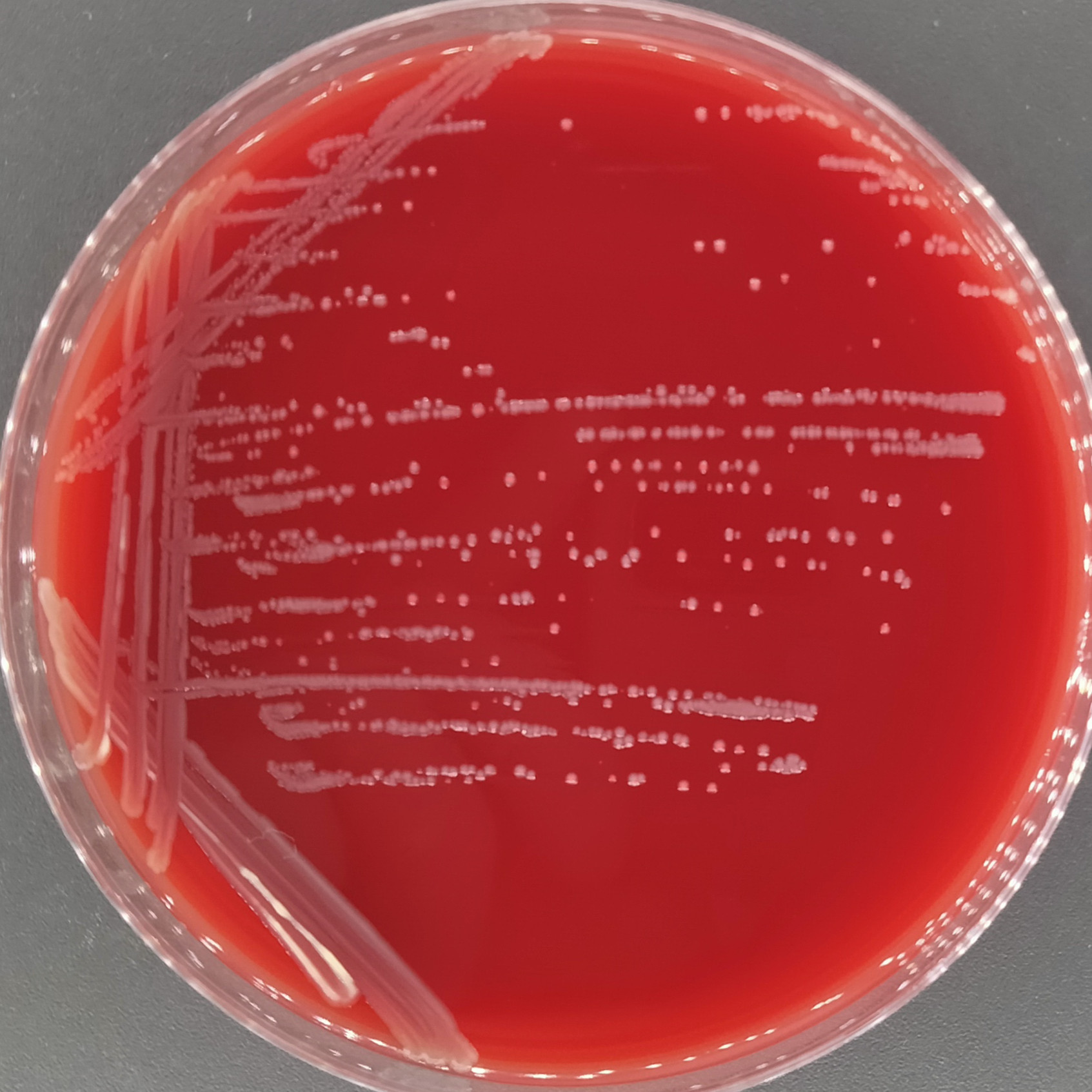 Wuhou Acinetobacter-BNCC