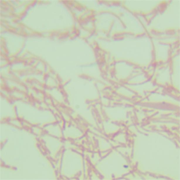 Staphylococcus aureus-BNCC