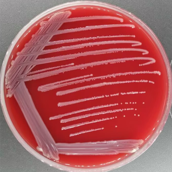 Escherichia coli-BNCC