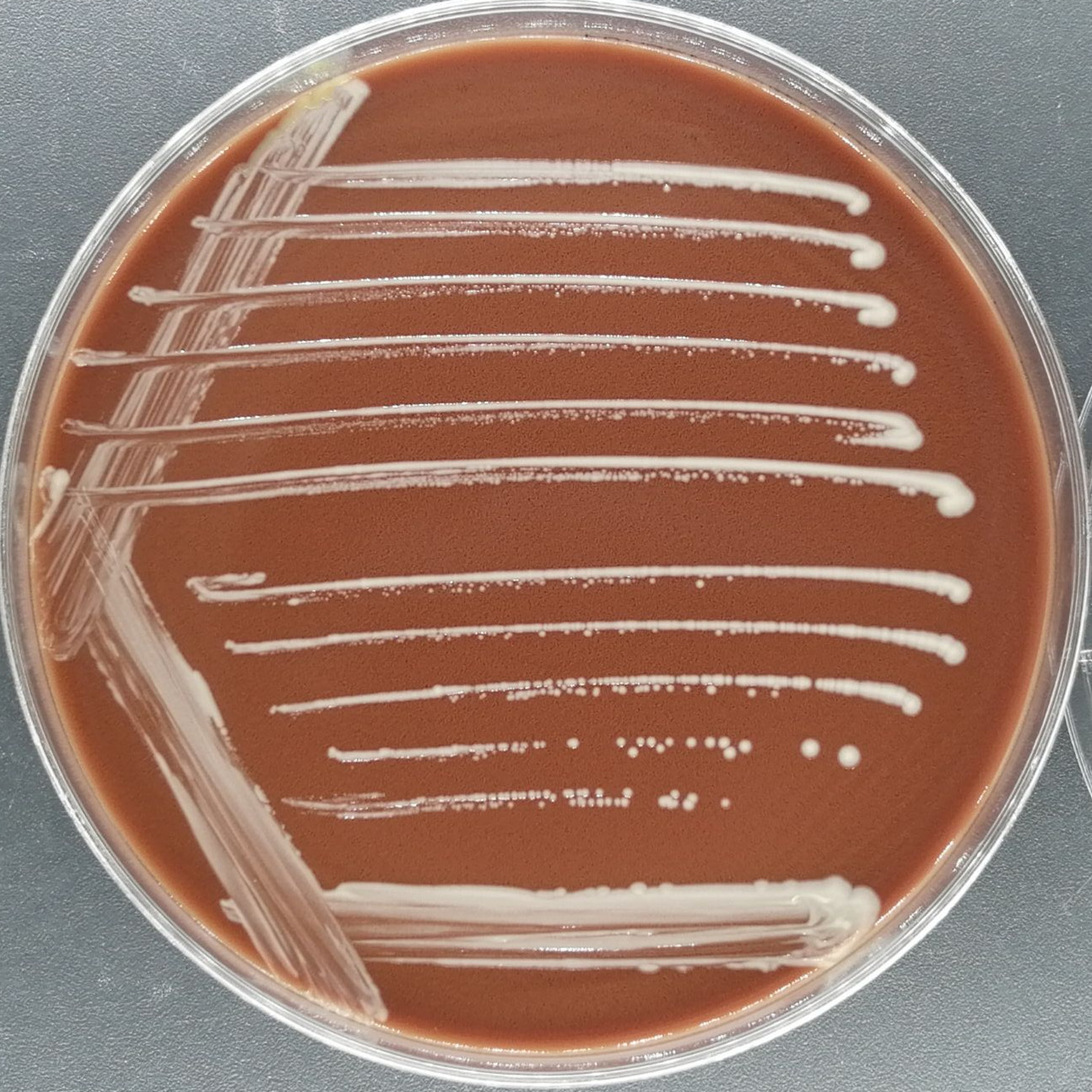 Lactobacillus acidophilus-BNCC