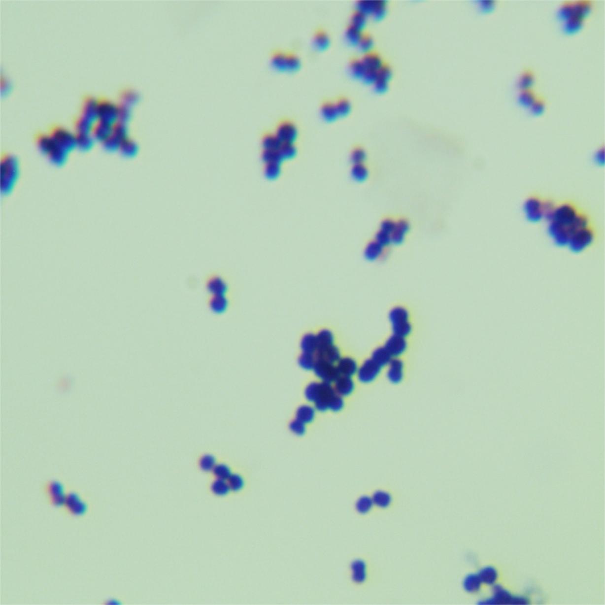 Buried roaming cocci-BNCC