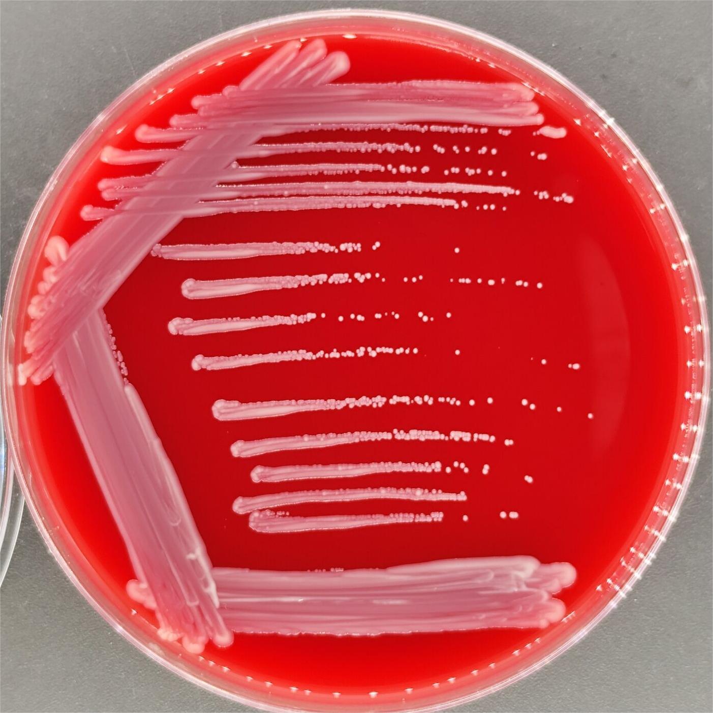 Corynebacterium diphtheriae subspecies-BNCC