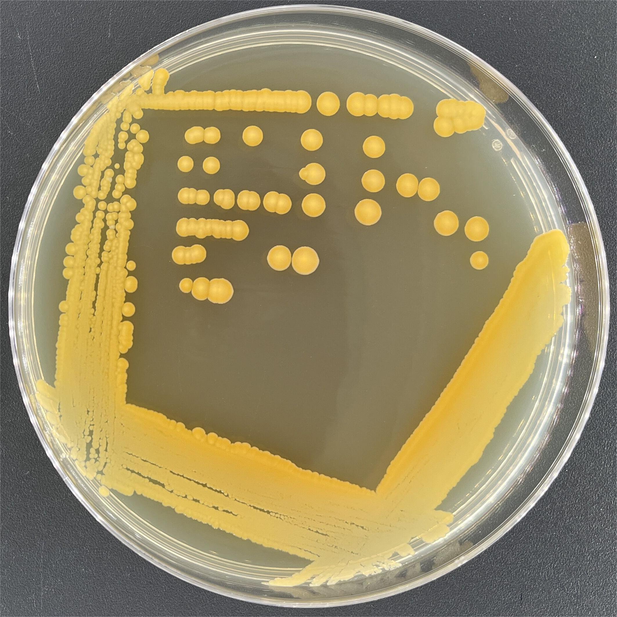 Staphylococcus aureus subsp. aureus-BNCC