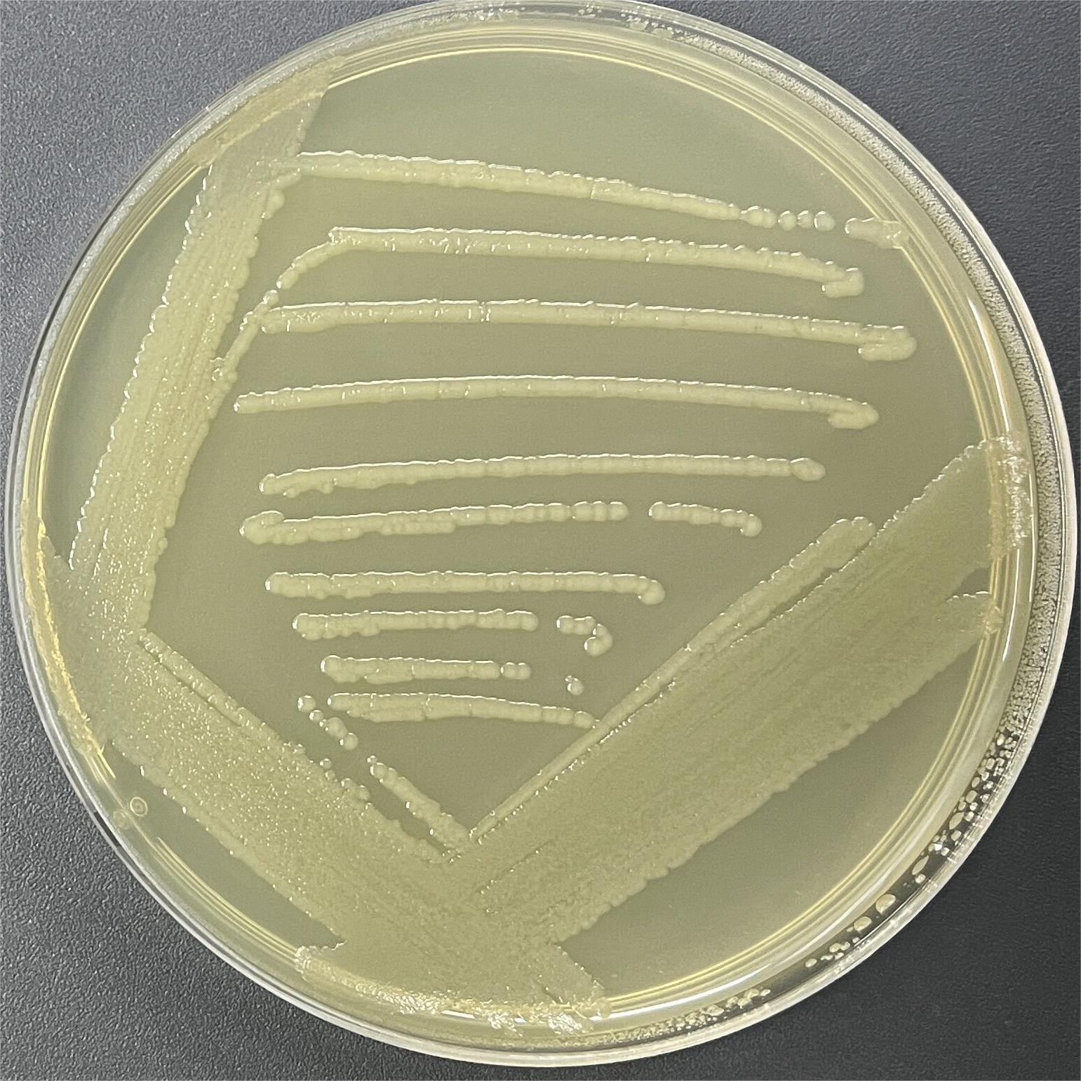 Escherichia coli-BNCC