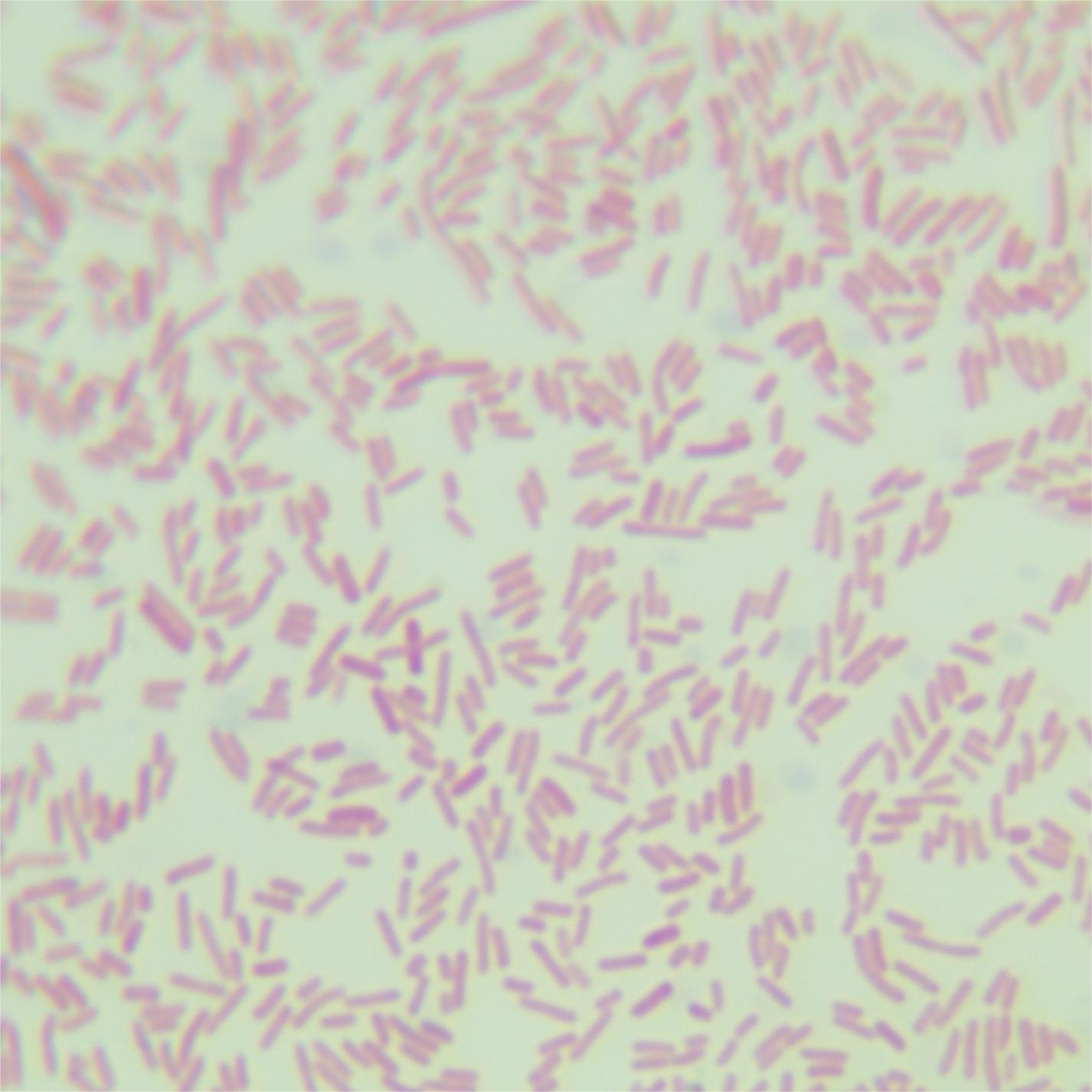 Escherichia coli-BNCC