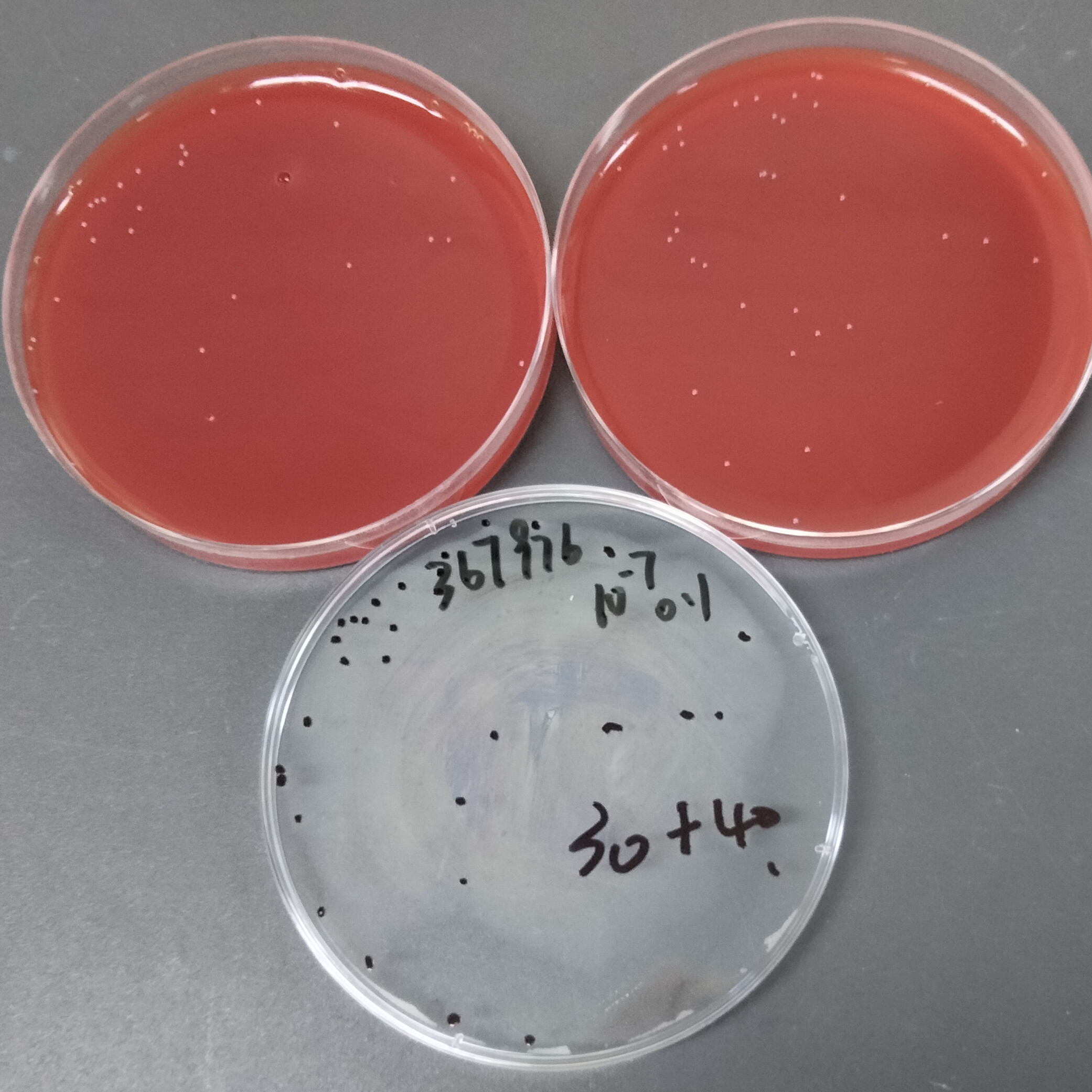 Streptococcus agalactiae-BNCC