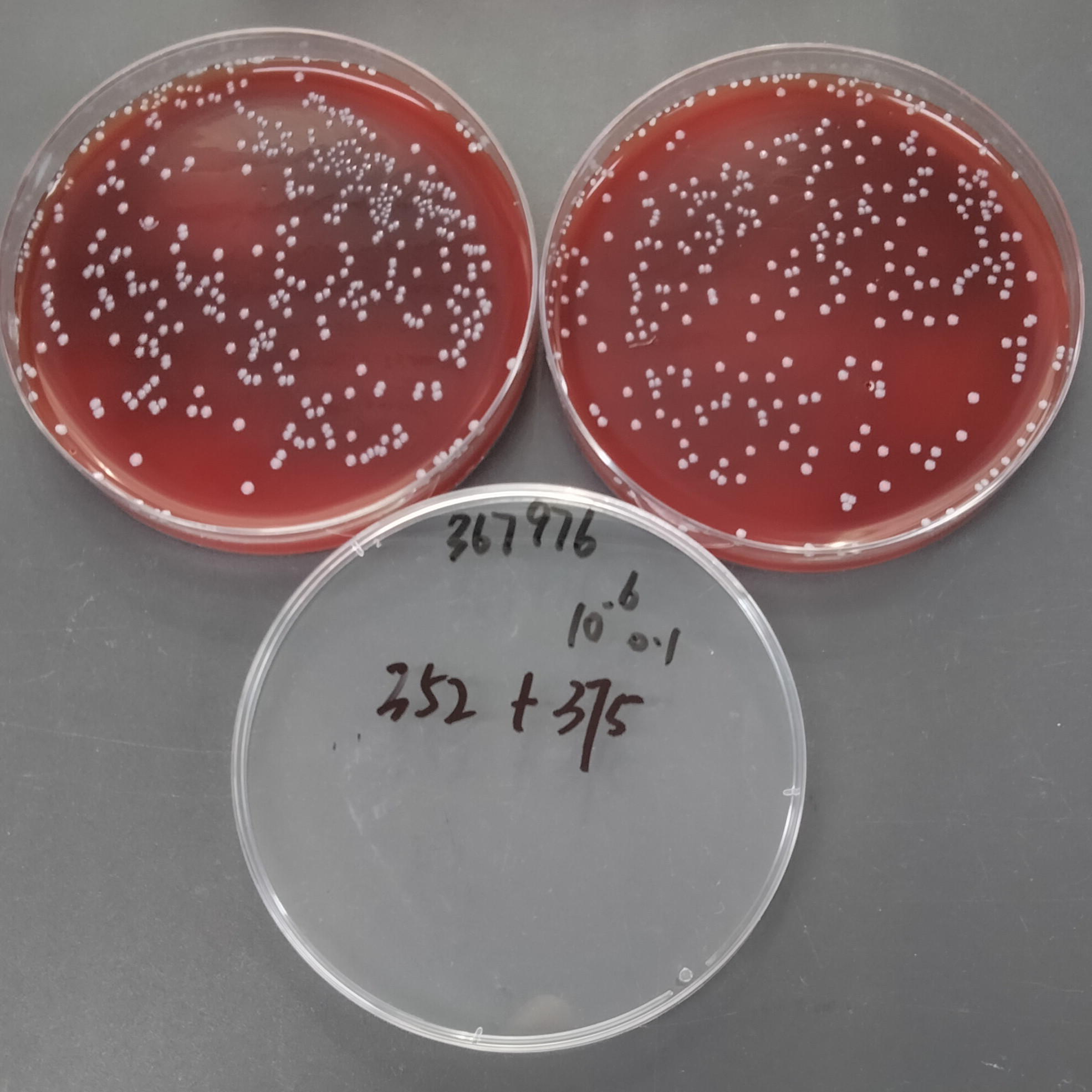 Streptococcus agalactiae-BNCC