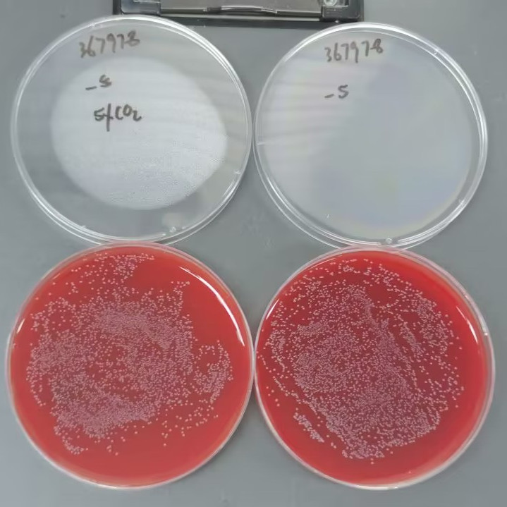 Streptococcus agalactiae-BNCC