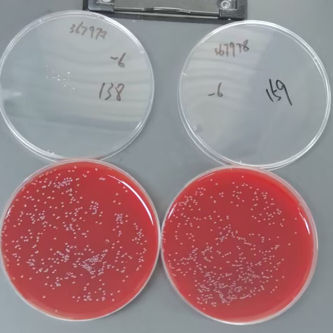 Streptococcus agalactiae-BNCC
