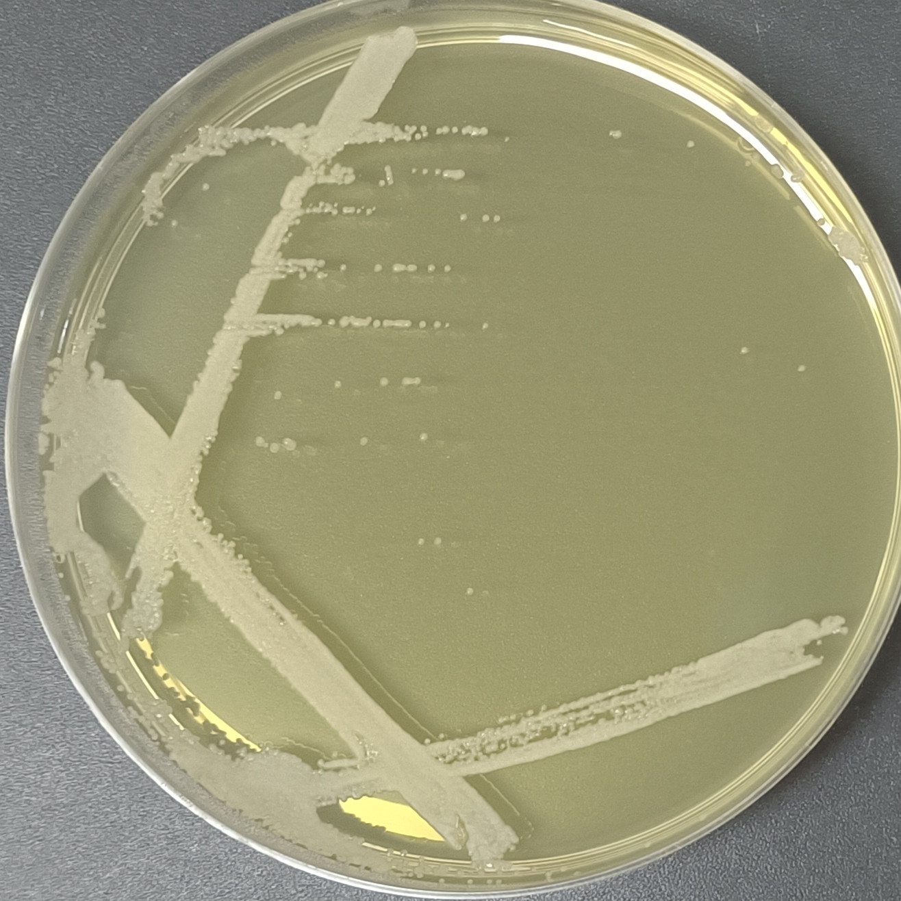 Saccharomyces cerevisiae-BNCC