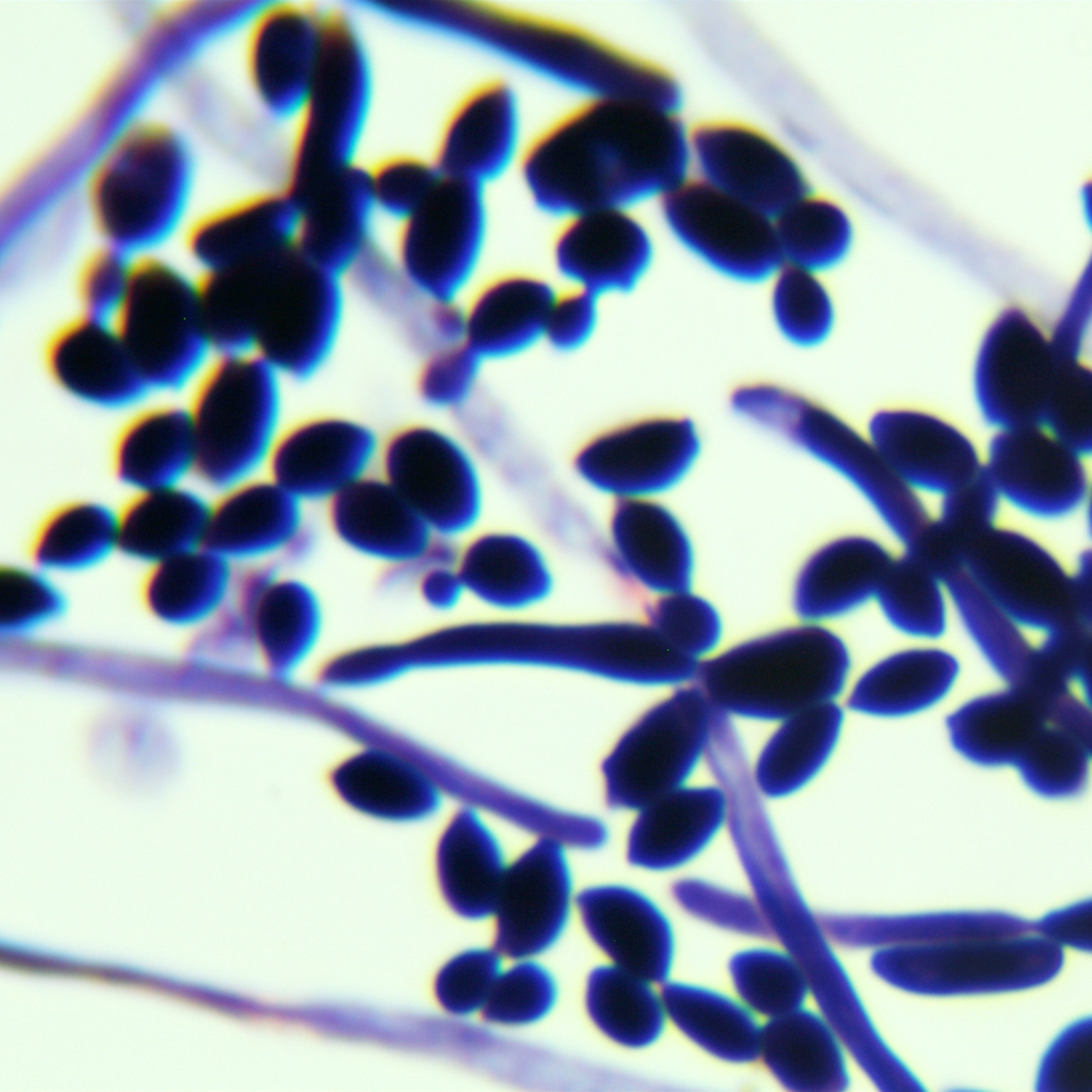 Saccharomyces cerevisiae-BNCC
