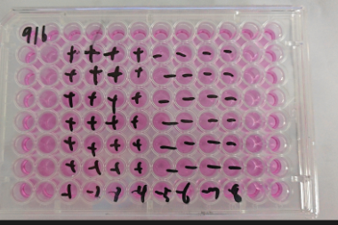 Human Herpesvirus 3-BNCC