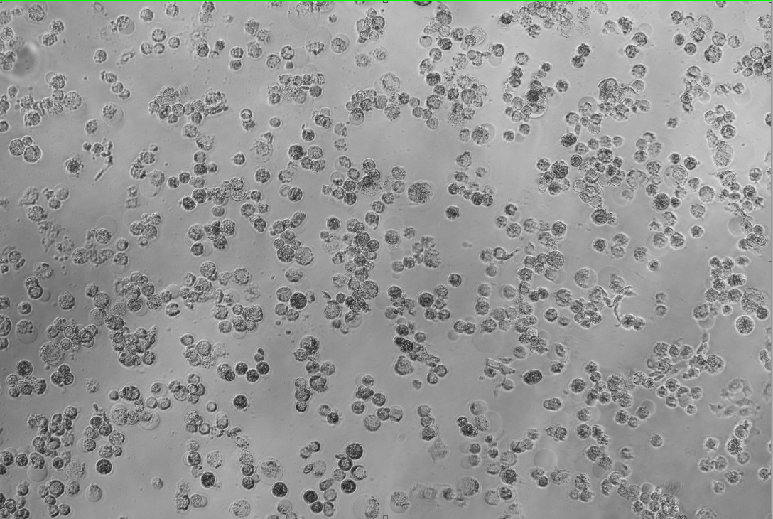 Human adenovirus 17-BNCC