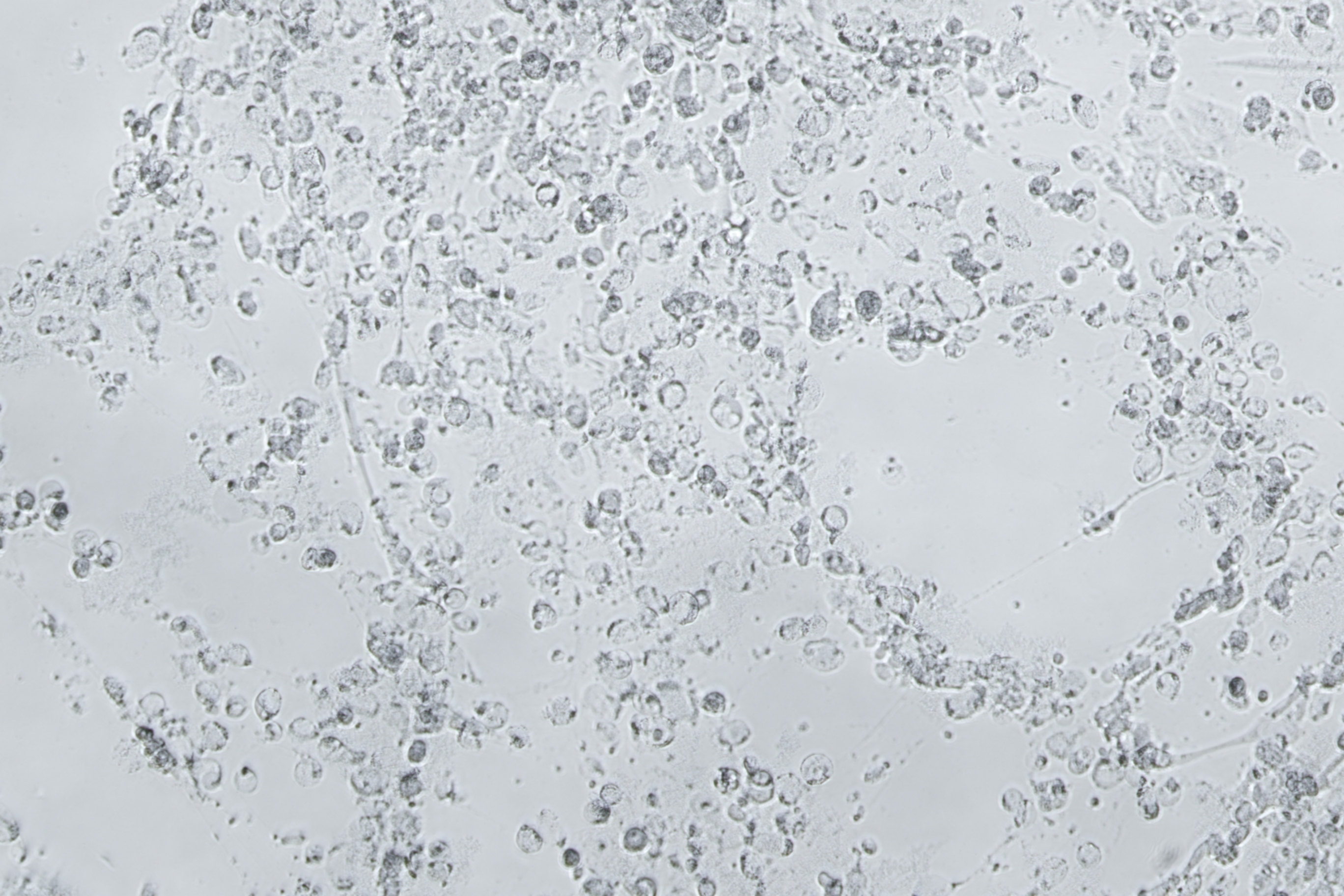 Human adenovirus 19-BNCC