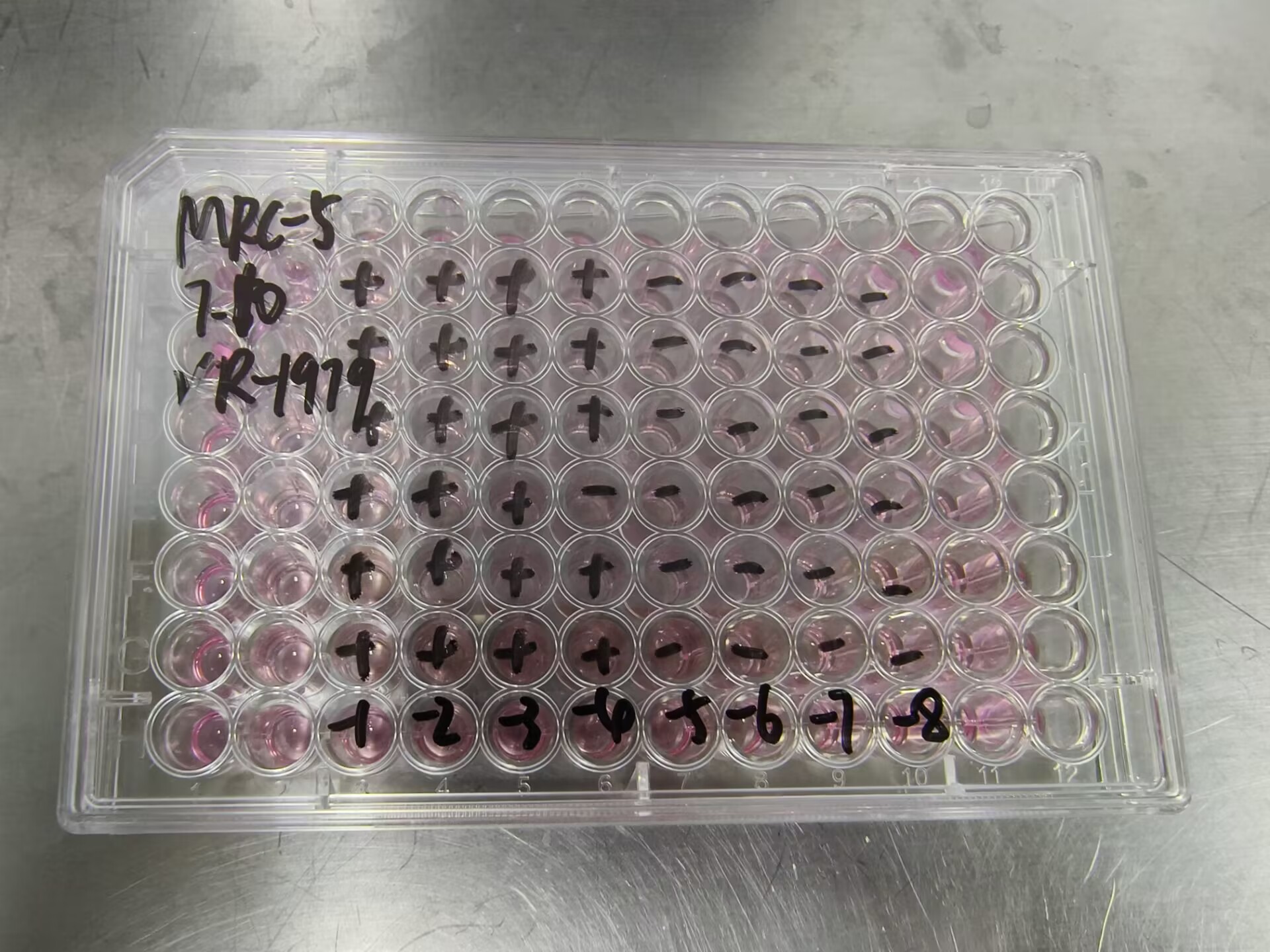 Human adenovirus 19-BNCC