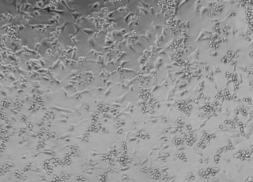 JC Polyomavirus-BNCC