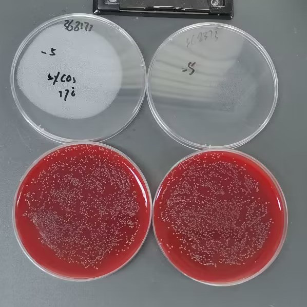 Streptococcus agalactiae-BNCC