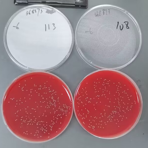Streptococcus agalactiae-BNCC
