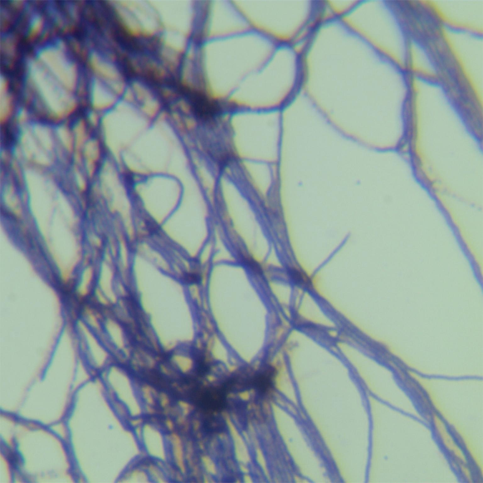 Madura actinomycetes-BNCC