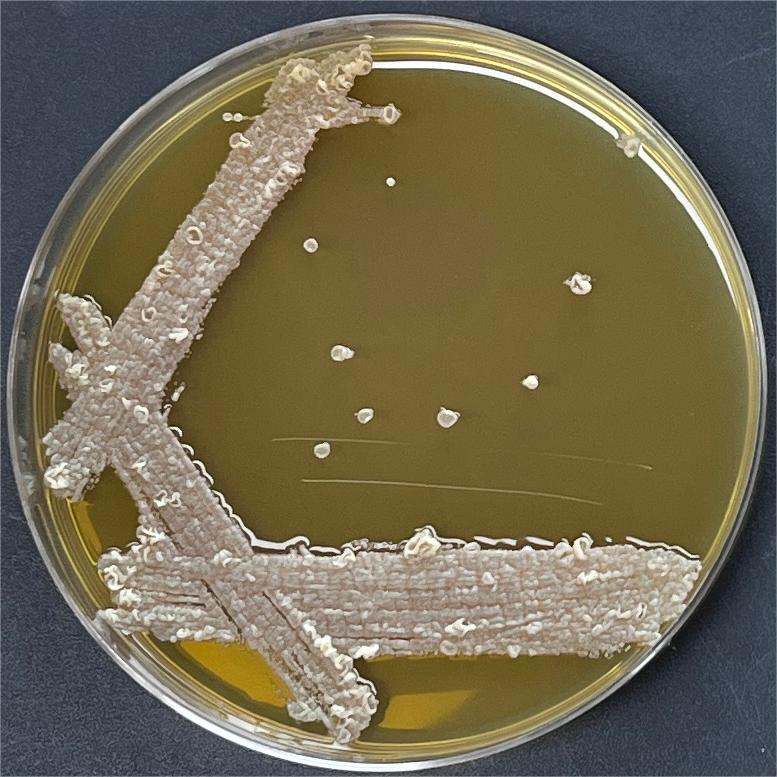 Madura actinomycetes-BNCC
