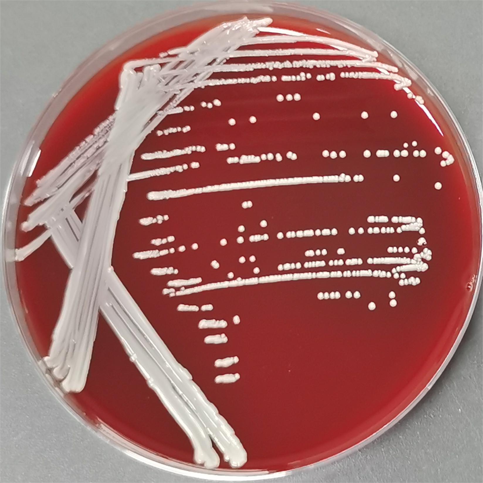 Dental root actinomycetes-BNCC