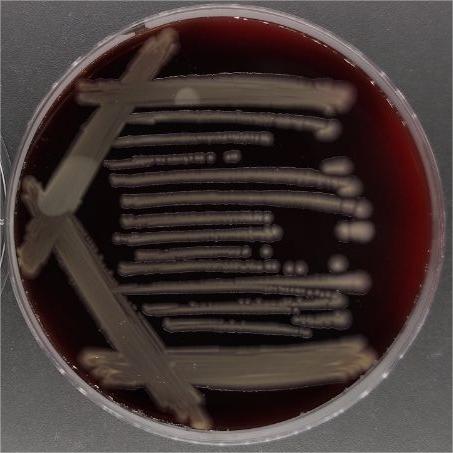 Pseudomonas aeruginosa subsp. hydrophila-BNCC