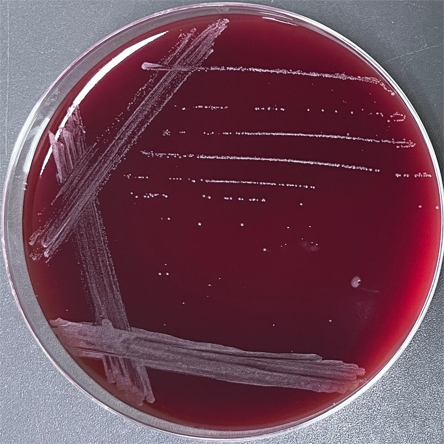 Propionibacterium-BNCC