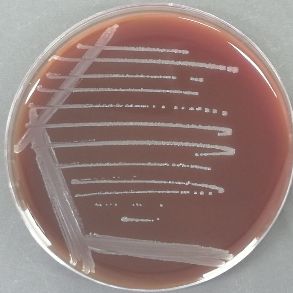 Venturi Bartonella Arupo subspecies-BNCC