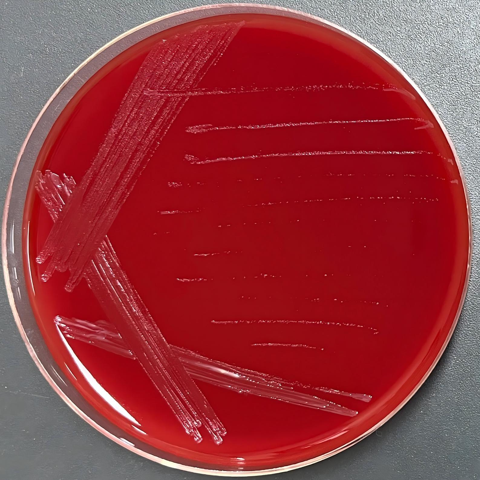 Wens Bartonella Wens subspecies-BNCC