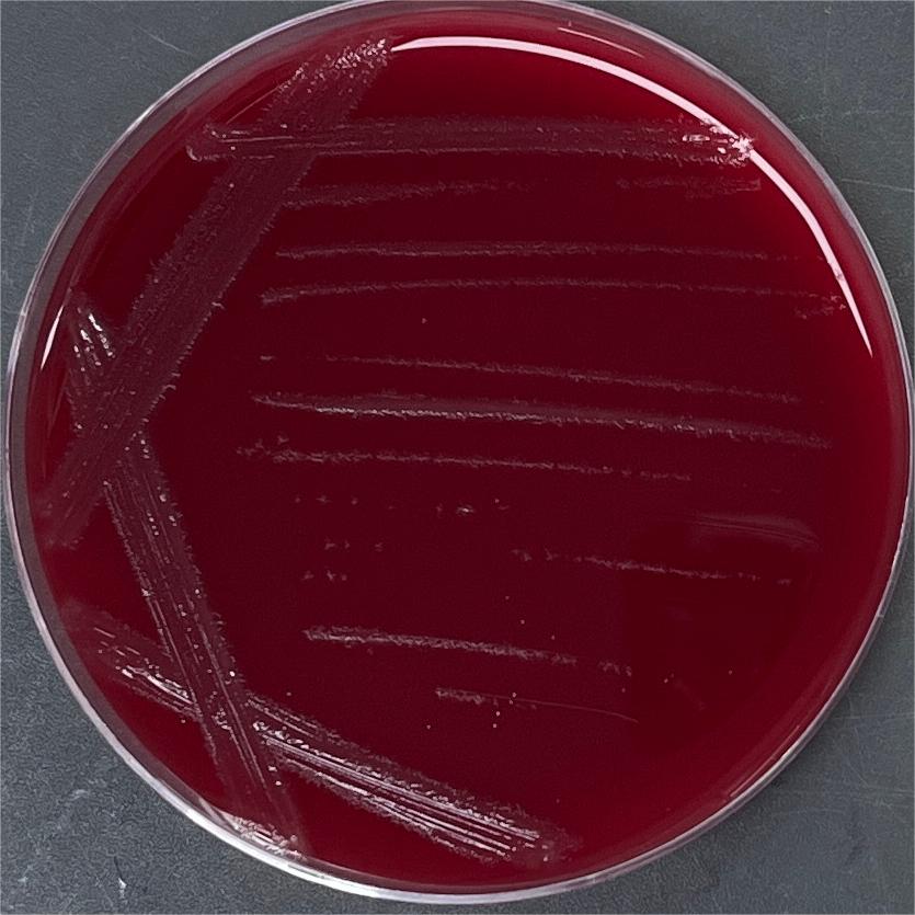 Clostridium tetani-BNCC