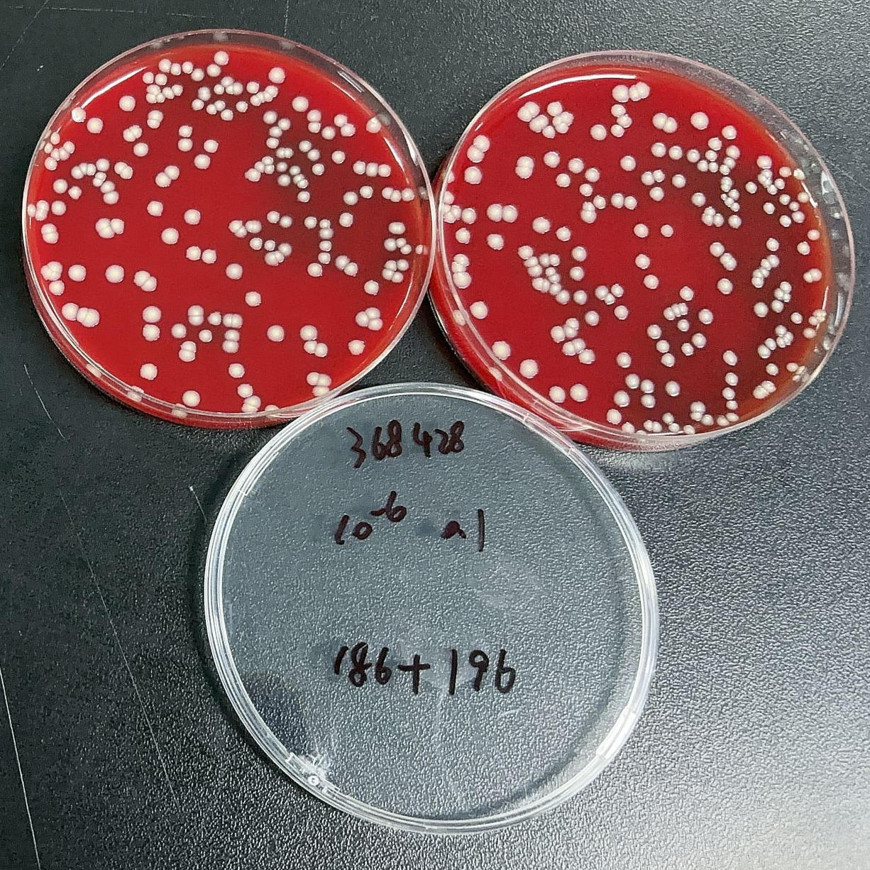 Corynebacterium diphtheriae-BNCC