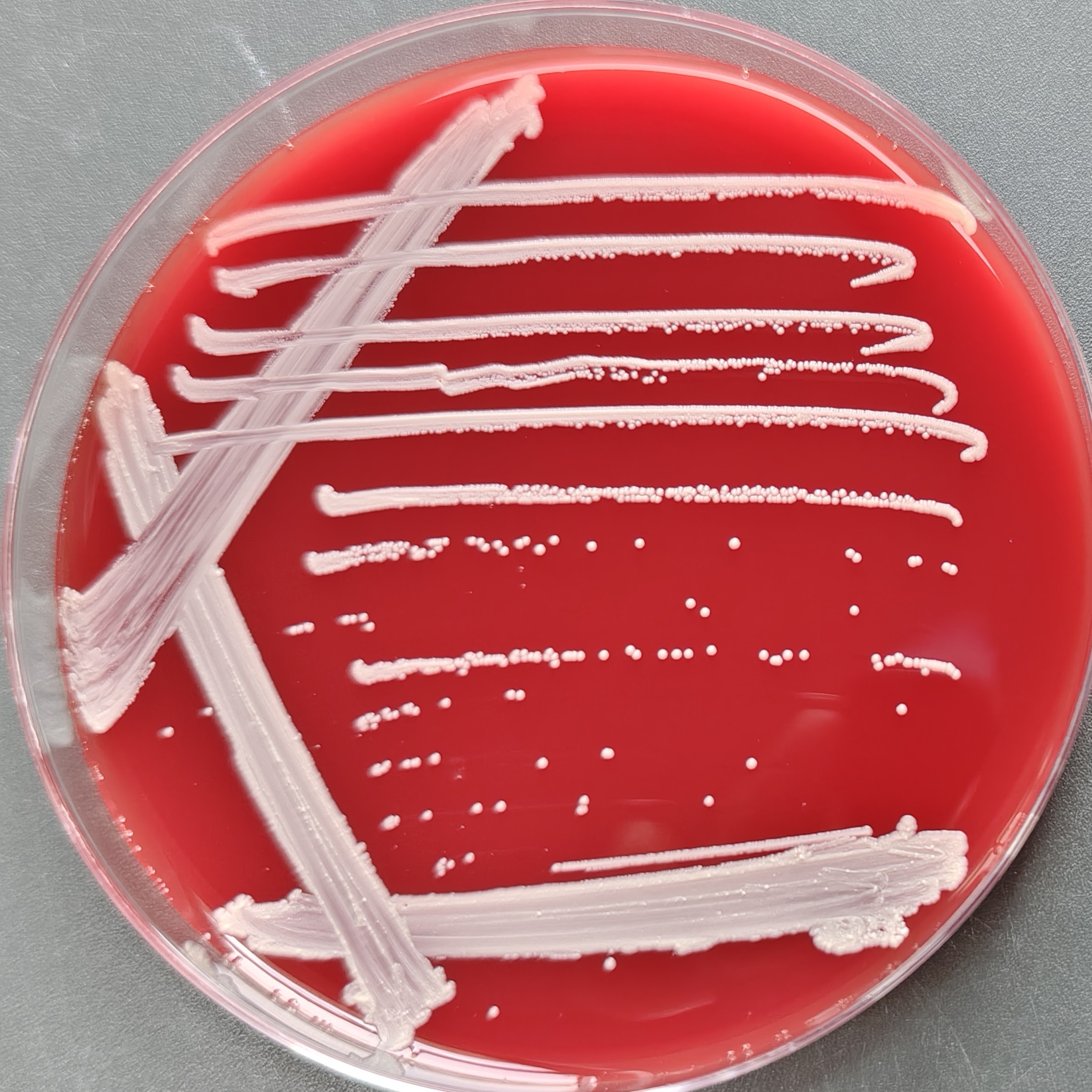 Fake Mycobacterium tuberculosis-BNCC