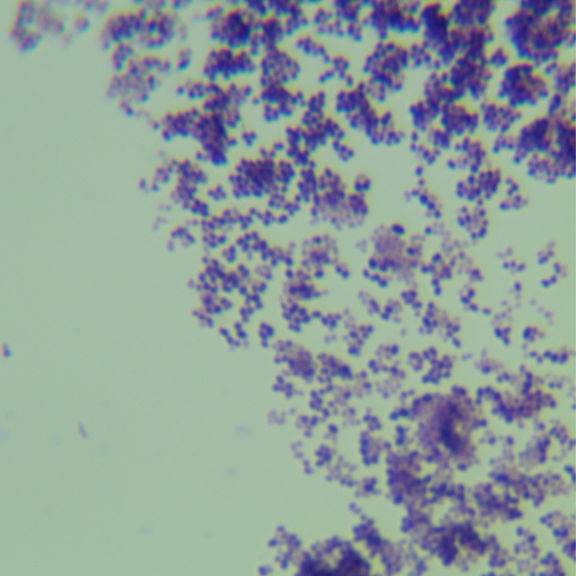 Fake Mycobacterium tuberculosis-BNCC