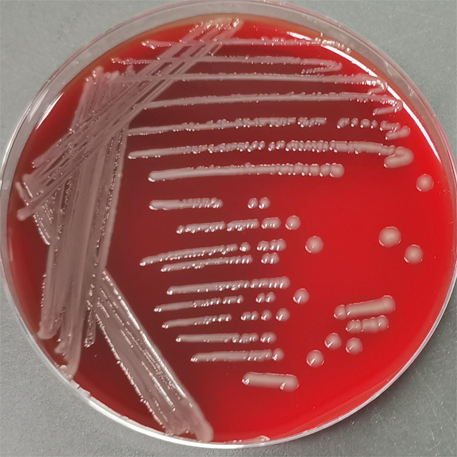 Slow Edwardian bacteria-BNCC