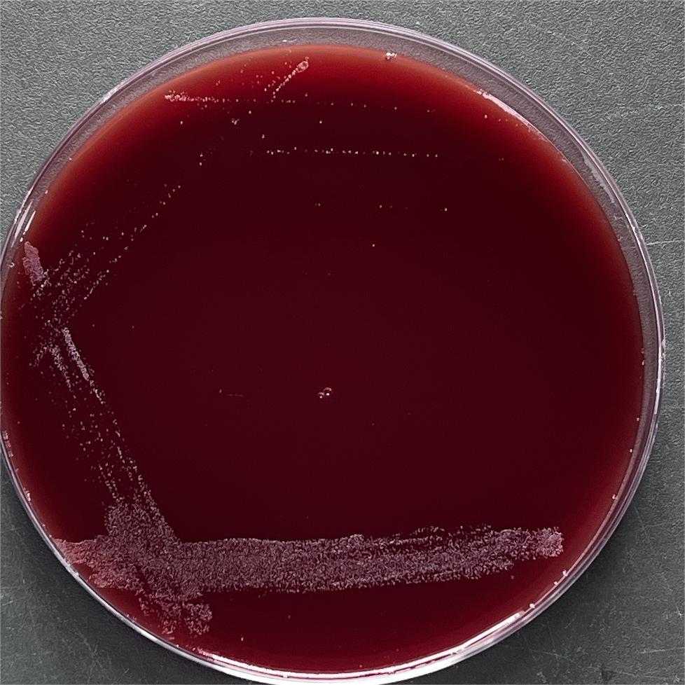 Vernier's Babesia subspecies-BNCC