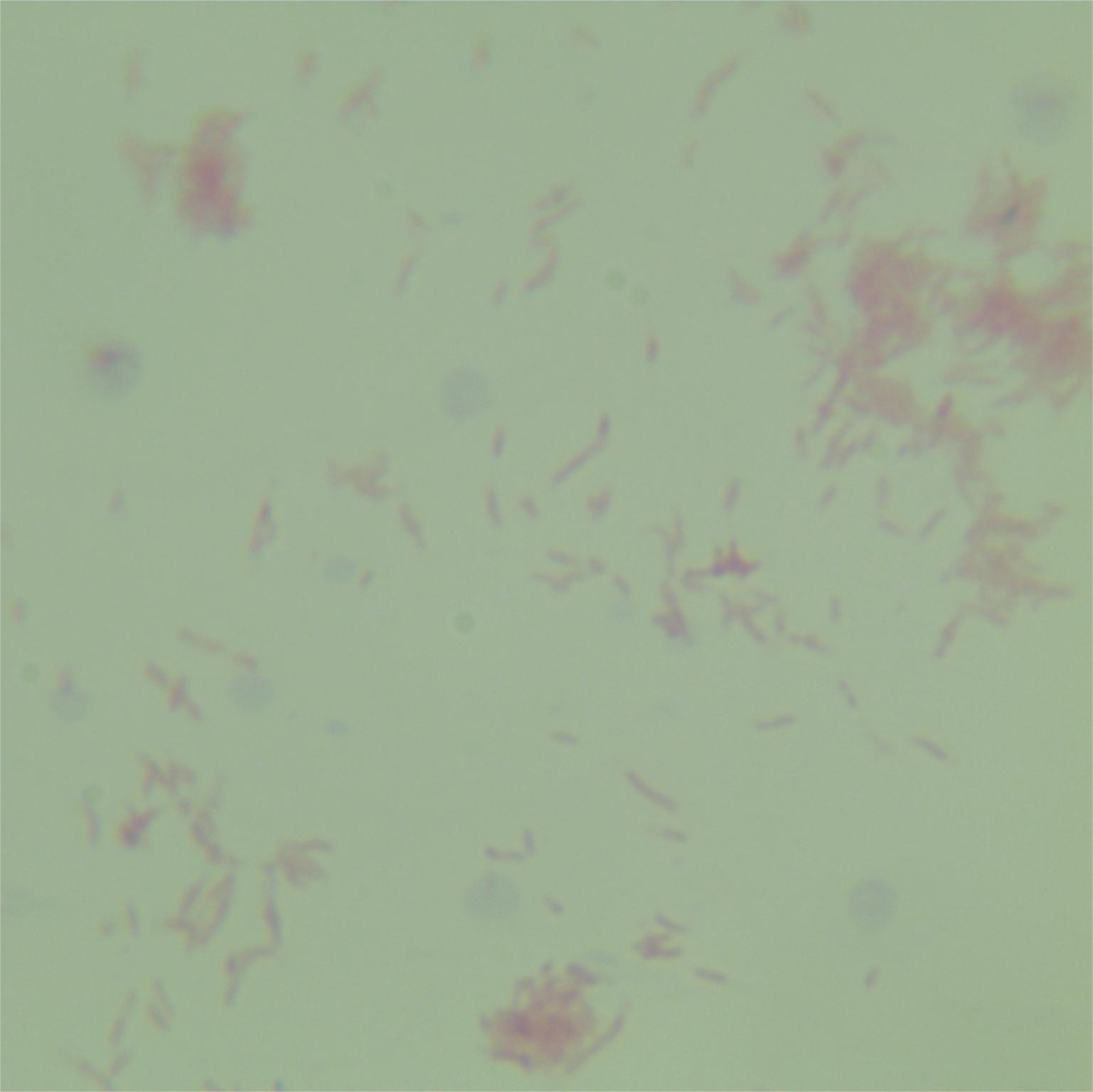 Vernier's Babesia subspecies-BNCC