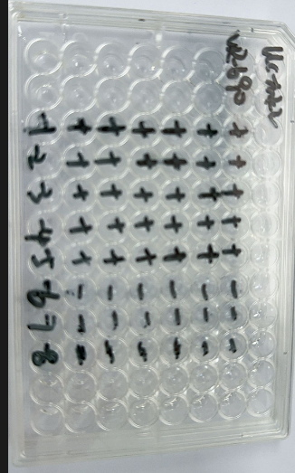 Human echovirus 21-BNCC