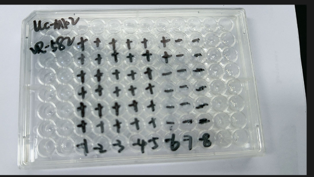 Human echovirus 33-BNCC