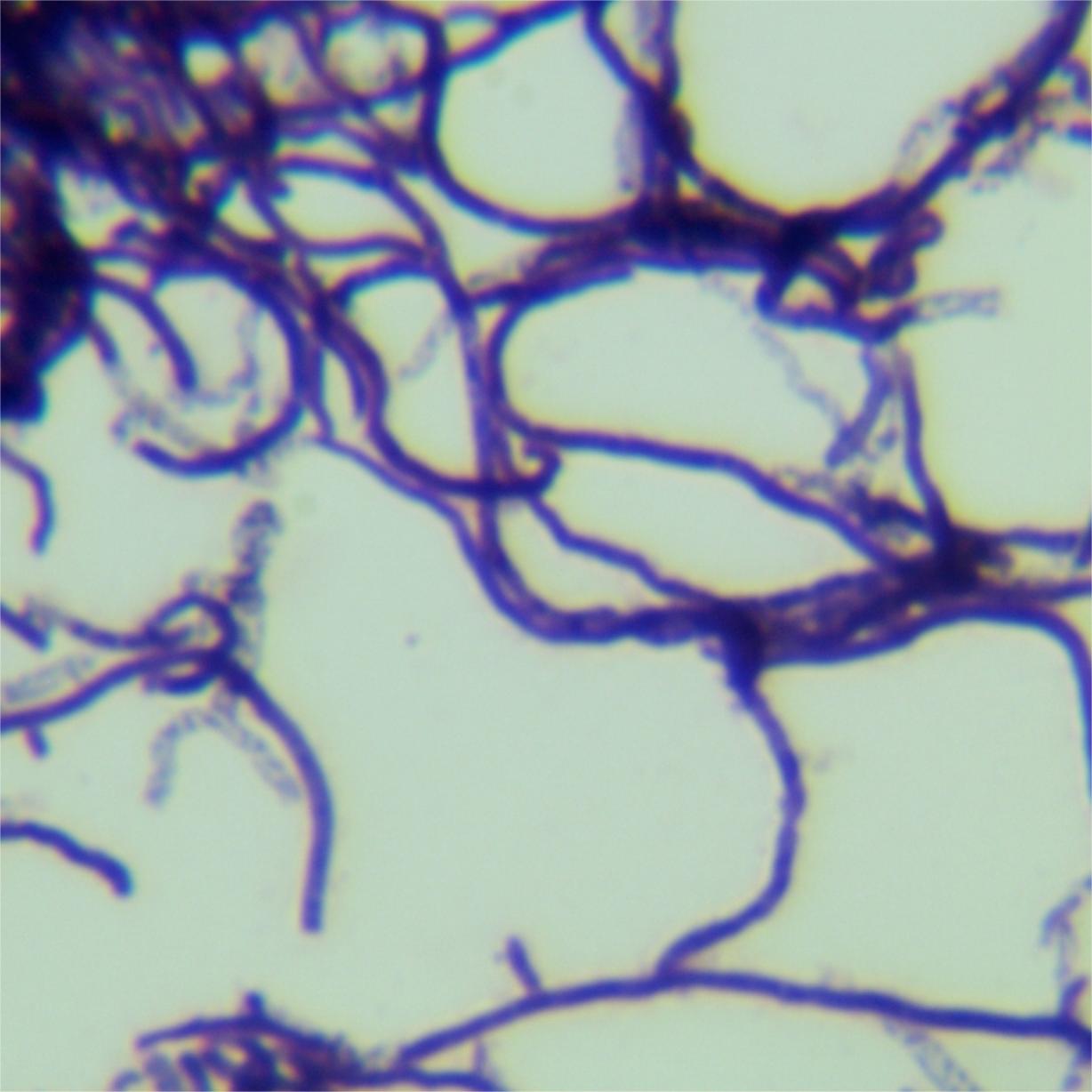 Streptomyces-BNCC