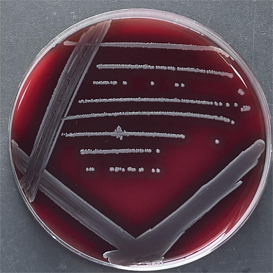 Listeria reinhardtii subsp. reinhardtii-BNCC