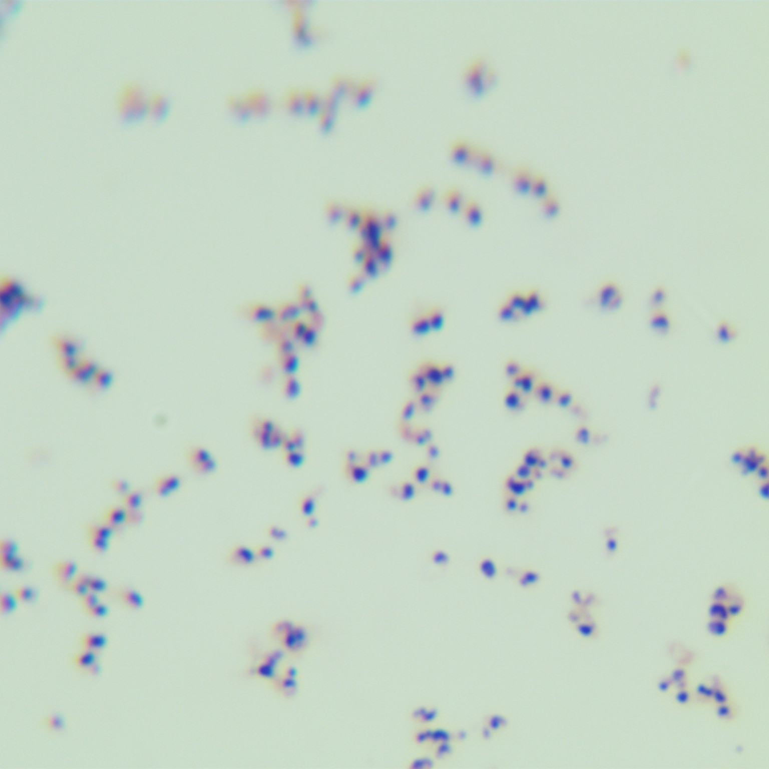Brazilian Nocardia-BNCC