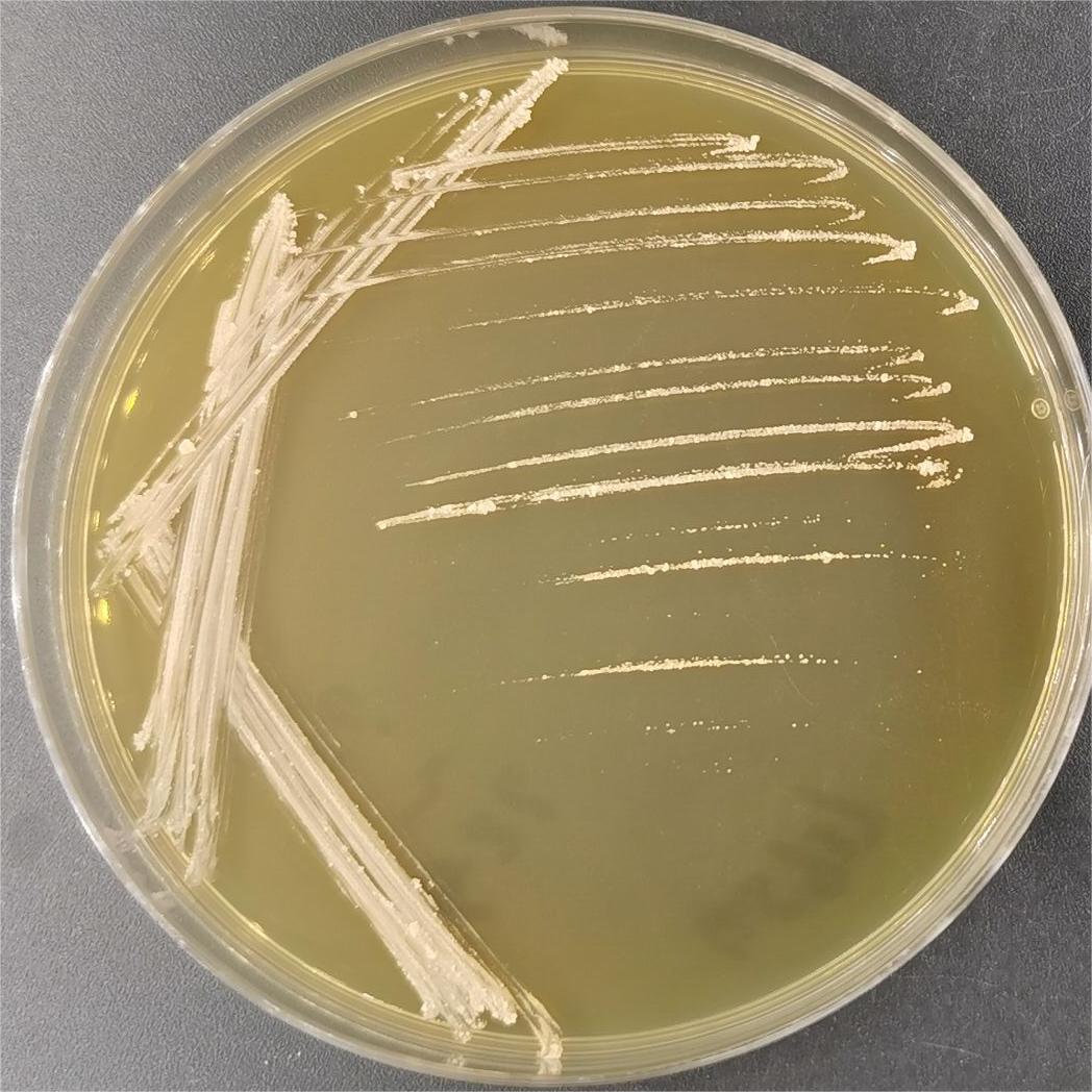Transvanocardia-BNCC