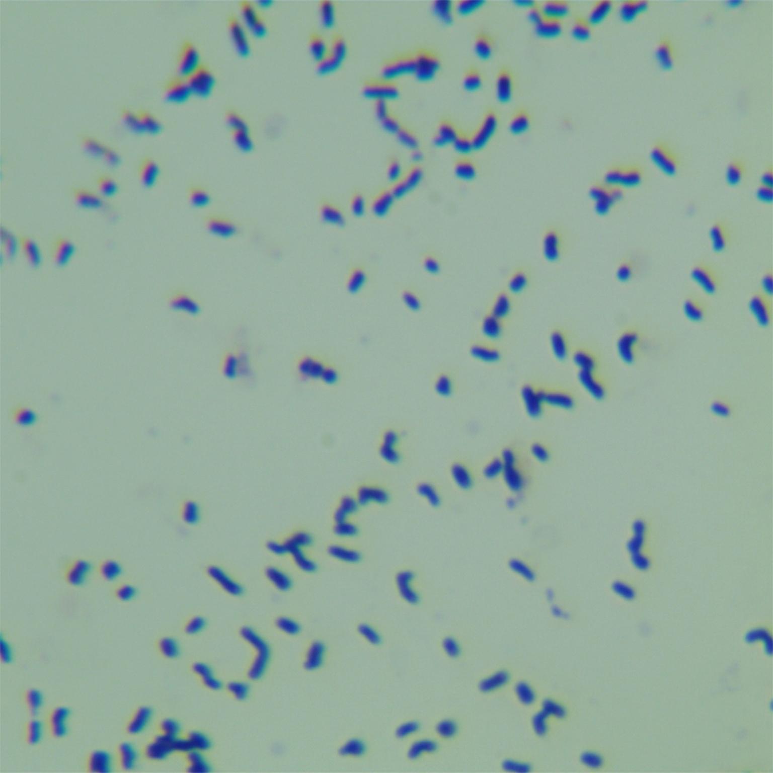 Transvanocardia-BNCC