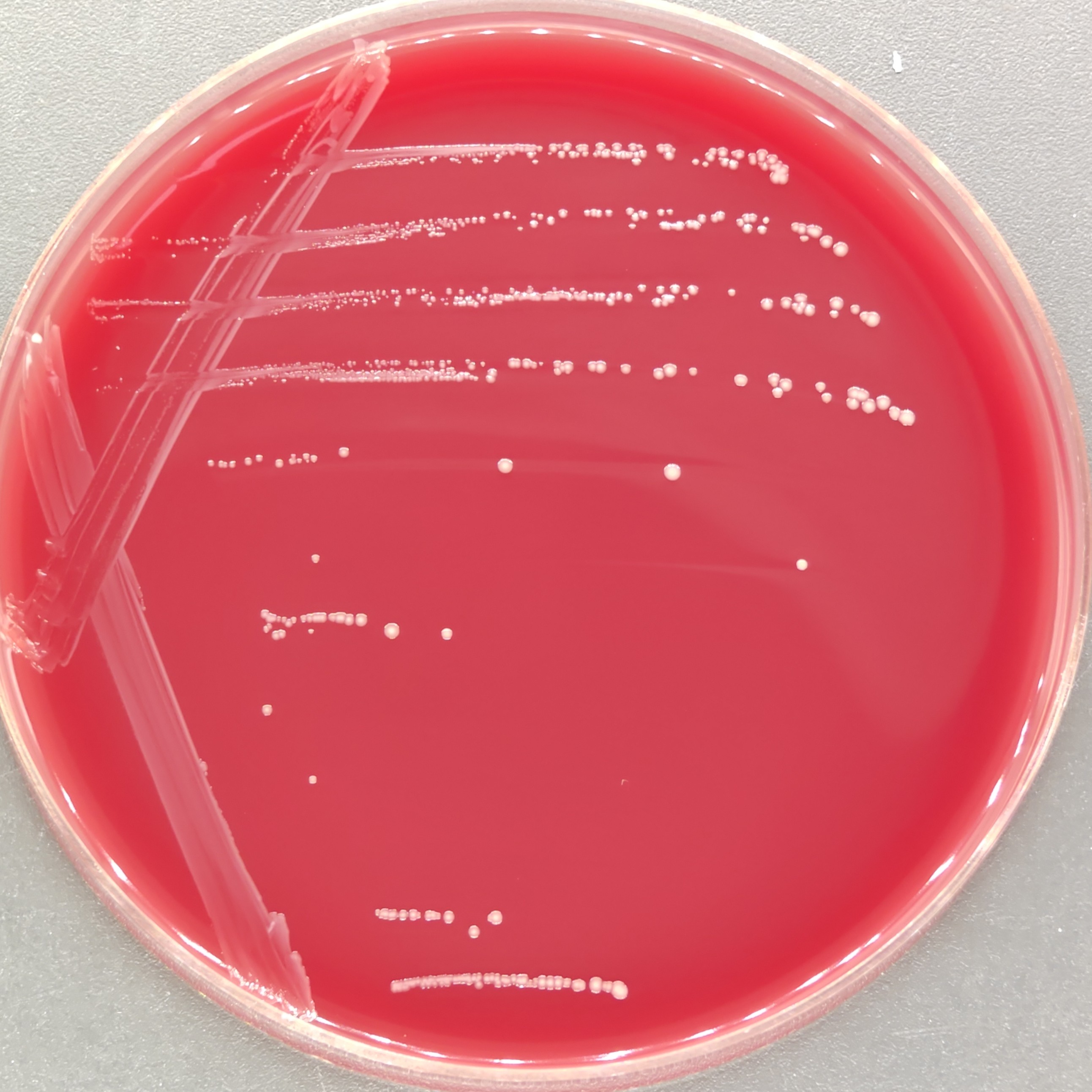 Gastrointestinal Streptococcus-BNCC