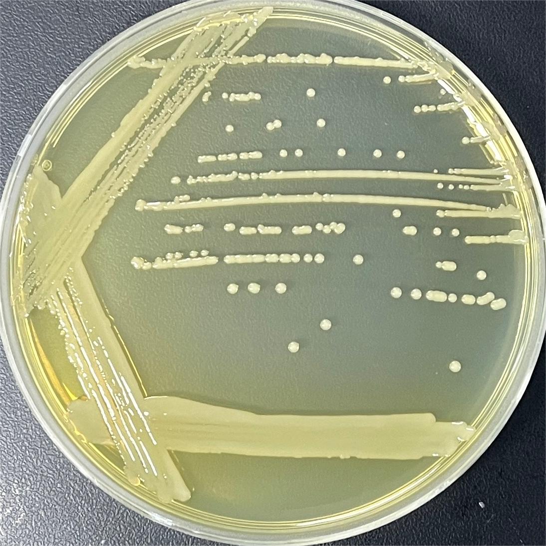 Acinetobacter baumannii-BNCC