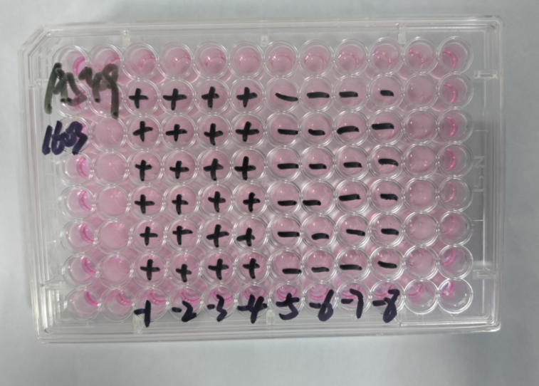 Human Adenovirus 51-BNCC