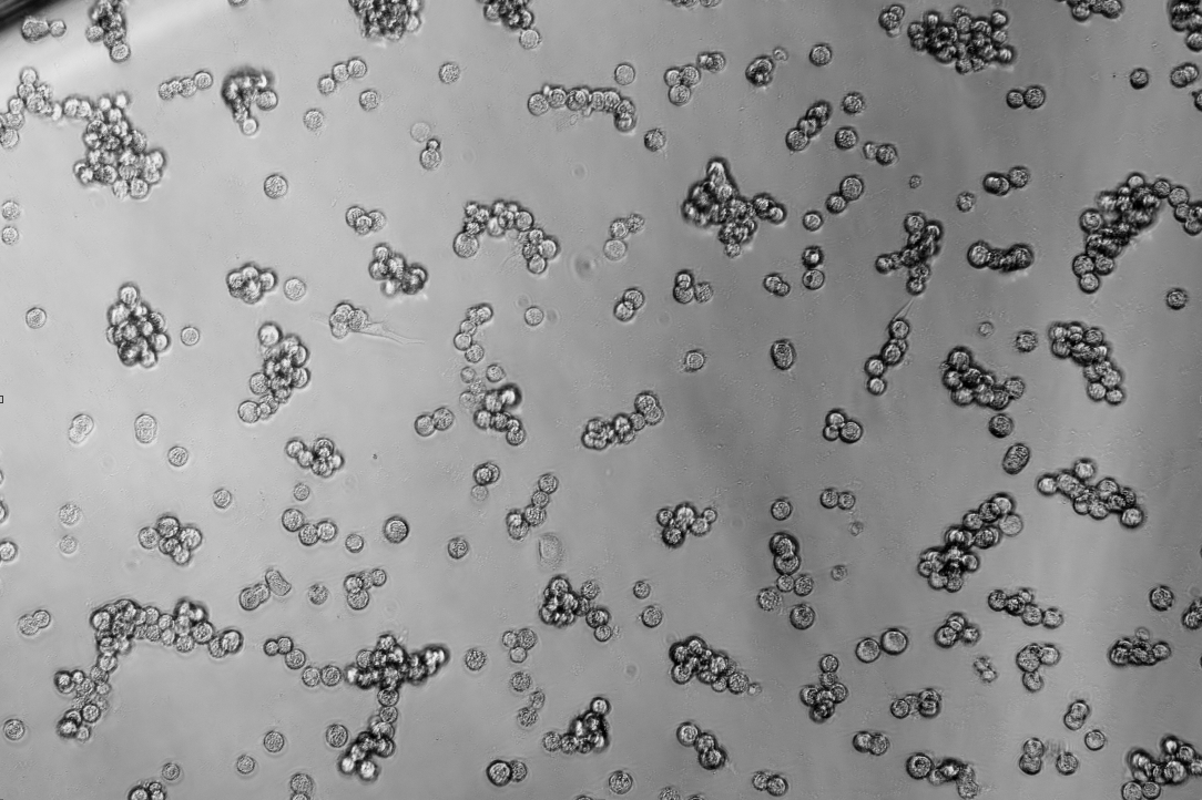 Human adenovirus 49-BNCC