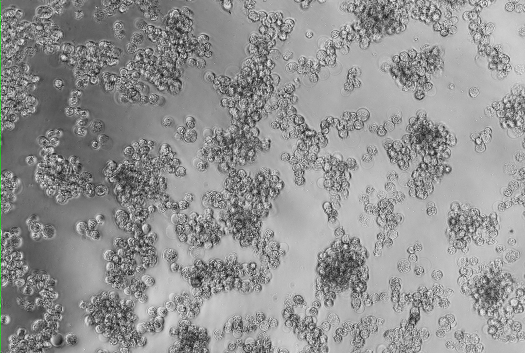 Human adenovirus 48°C-BNCC