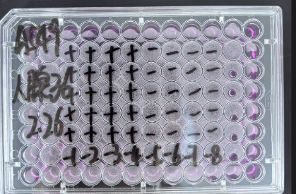 Human adenovirus 36-BNCC