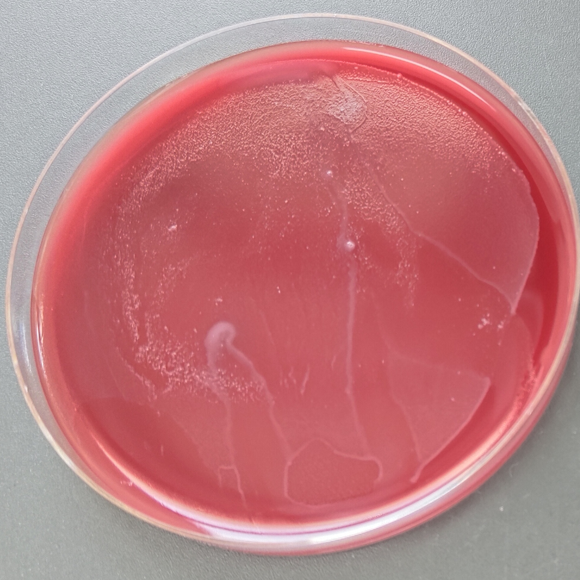 Difficult Clostridium difficile-BNCC